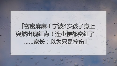 密密麻麻！宁波4岁孩子身上突然出现红点！连小便都变红了……家长：以为只是摔伤